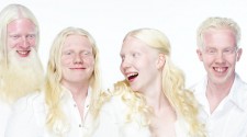 albinismus.jpg - kopie