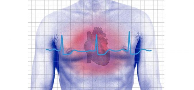 Následky infarktu myokardu